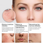 Serum facial con nicotinamida para cuidado de la piel